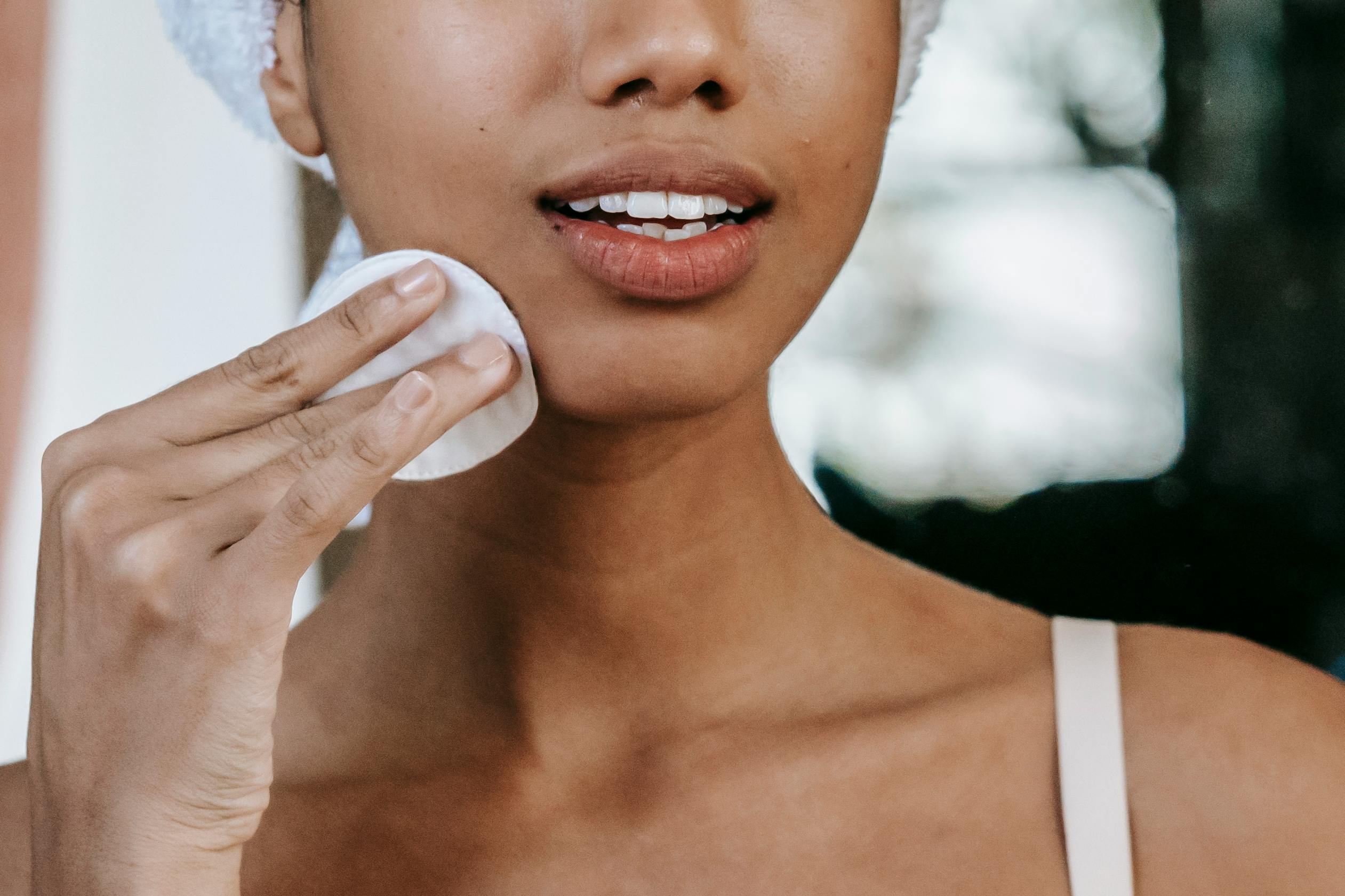 Acne en onzuiverheden